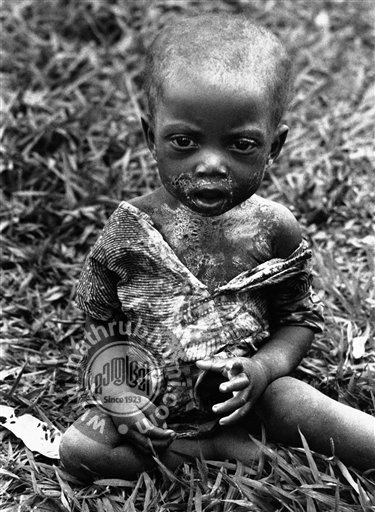 In this Jan. 26, 1961 file photo shot by Associated Press photographer Horst Faas, a sick and hungry Baluba child is photographed at the Miabi Hospital in South Kasai, Congo. Faas, a prize-winning combat photographer who carved out new standards for 

